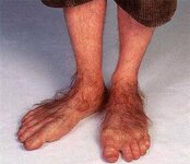 Hairy-feet.jpg