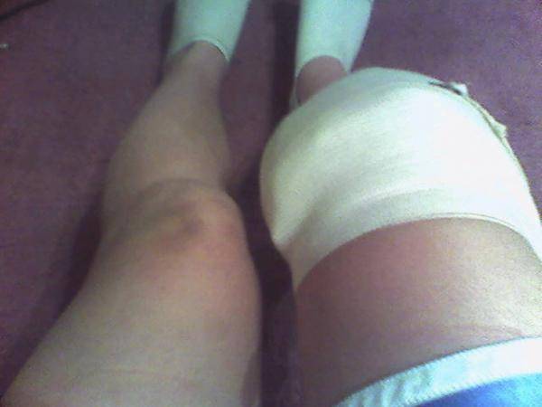 my poor knees after rodeoin